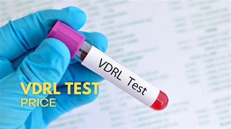 √ (Complete) Drug Test Price Philippines 2024 .